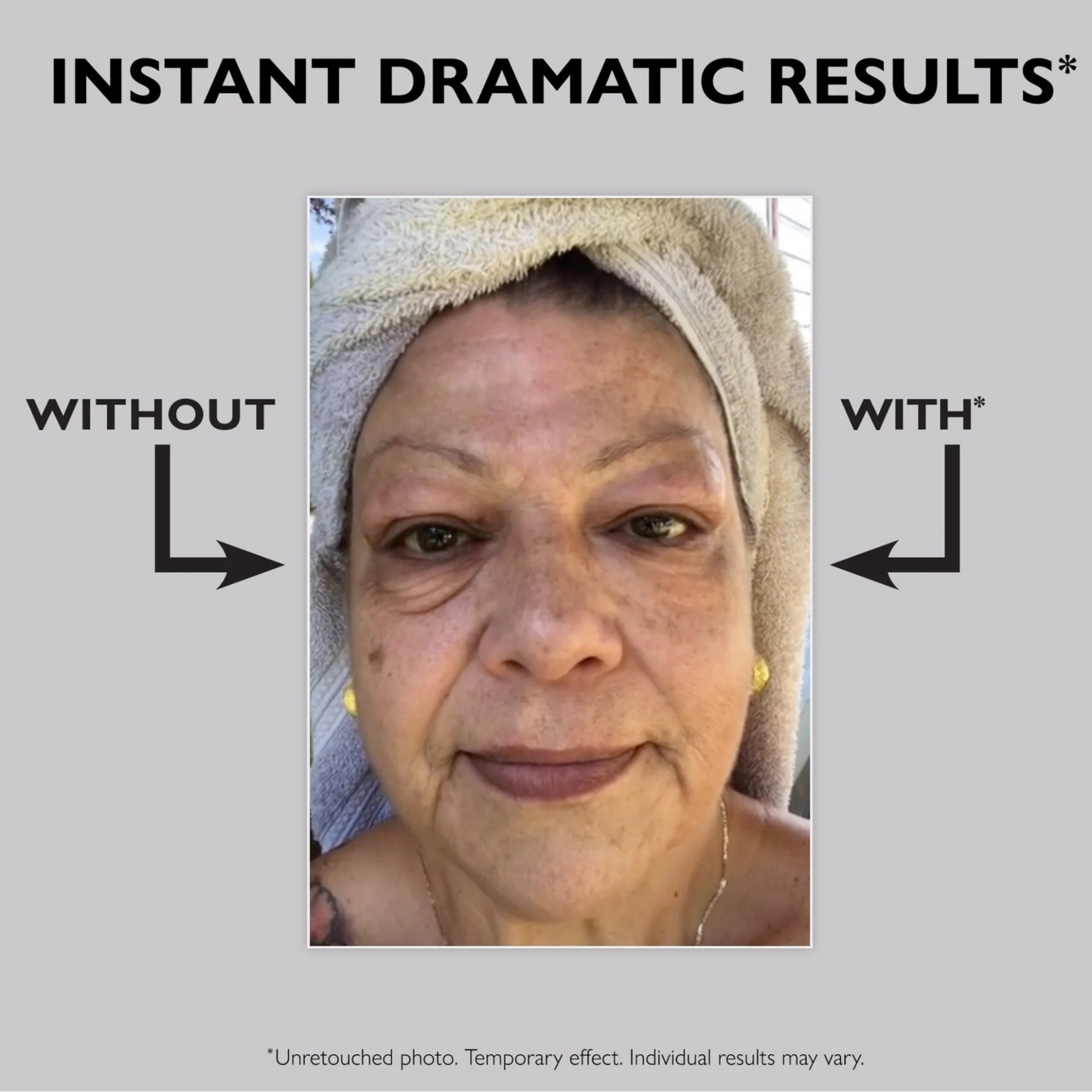 Instant FIRMx Eye Temporary Eye Tightener