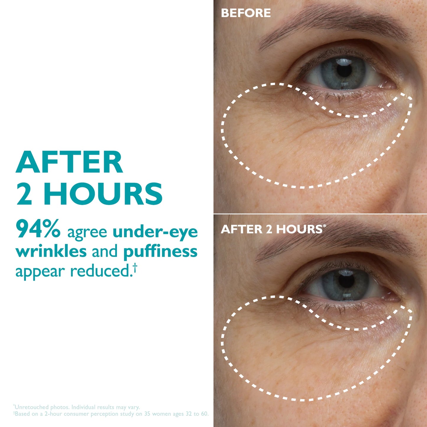Peptide Skinjection Peptide Infused Face + Eye Tape