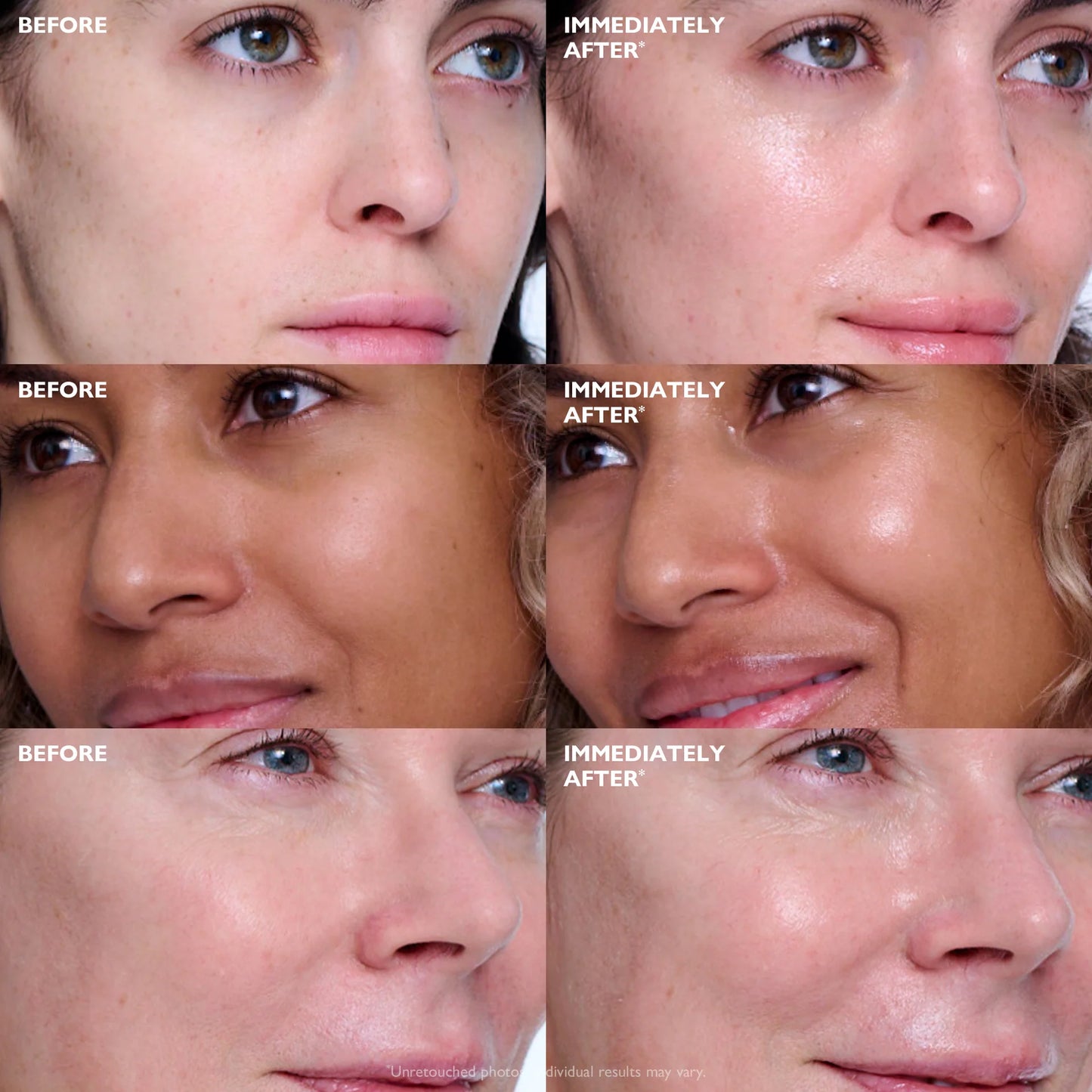 Collagen Skinjection Plumping & Firming Serum